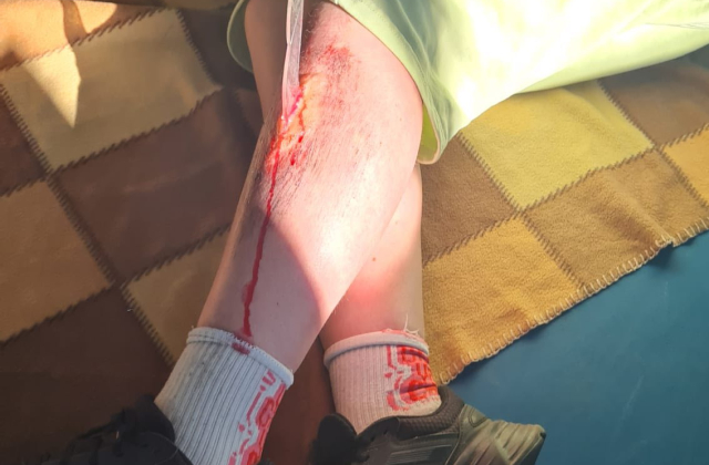 I Powiatowy Konkurs w Udzielaniu Pierwszej Pomocy dla Szkół Podstawowych